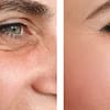 Choice Of Botox Injections National Deal - Image 2