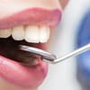 Choice Of Dental Treatment At Saphire Dent Dubai Dubai - Image 2
