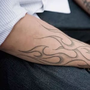 Three Sessions Of Laser Tattoo Removal: Small