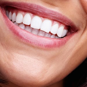 Dental Check-Up Dubai
