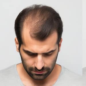 Extensions / Feathering Dubai