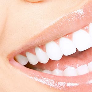 Scaling And Polishing With X-Ray At Omar Yahia Dental Surgery Clinic Dubai