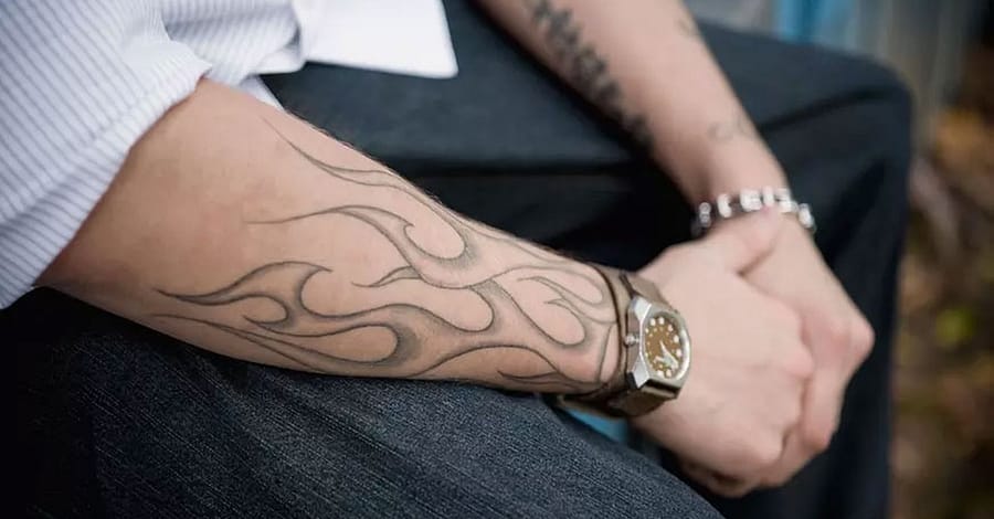 Three Sessions Of Laser Tattoo Removal: Small