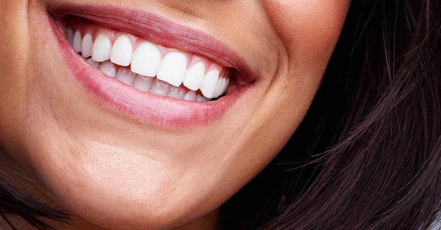 Dental Check-Up Dubai