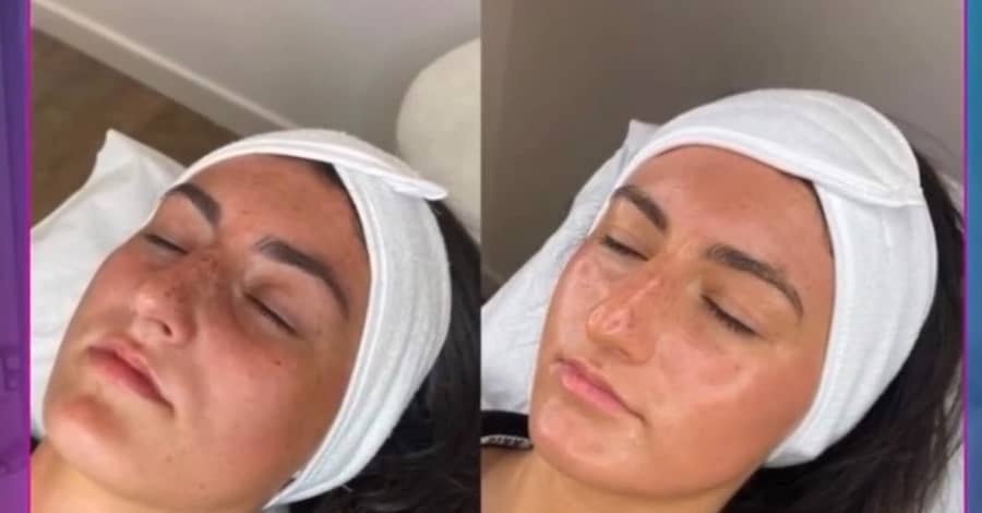 Facial - Anti-Ageing Dubai