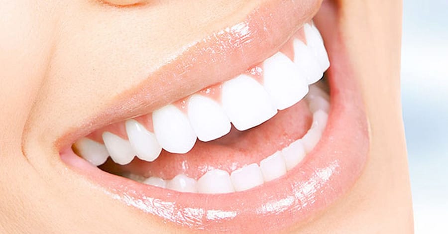 Scaling And Polishing With X-Ray At Omar Yahia Dental Surgery Clinic Dubai