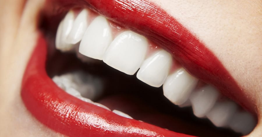 Or Laser Teeth Whitening Dubai